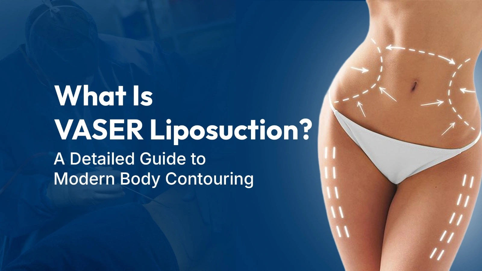 What Is VASER Liposuction? A Detailed Guide to Modern Body Contouring