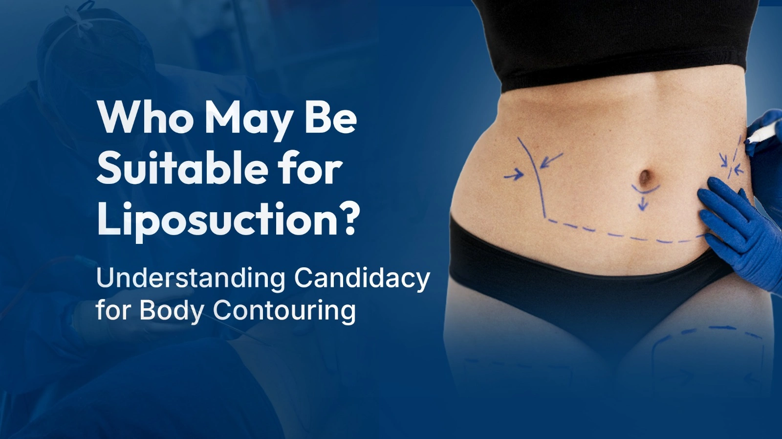 Who May Be Suitable for Liposuction? Understanding Candidacy for Body Contouring